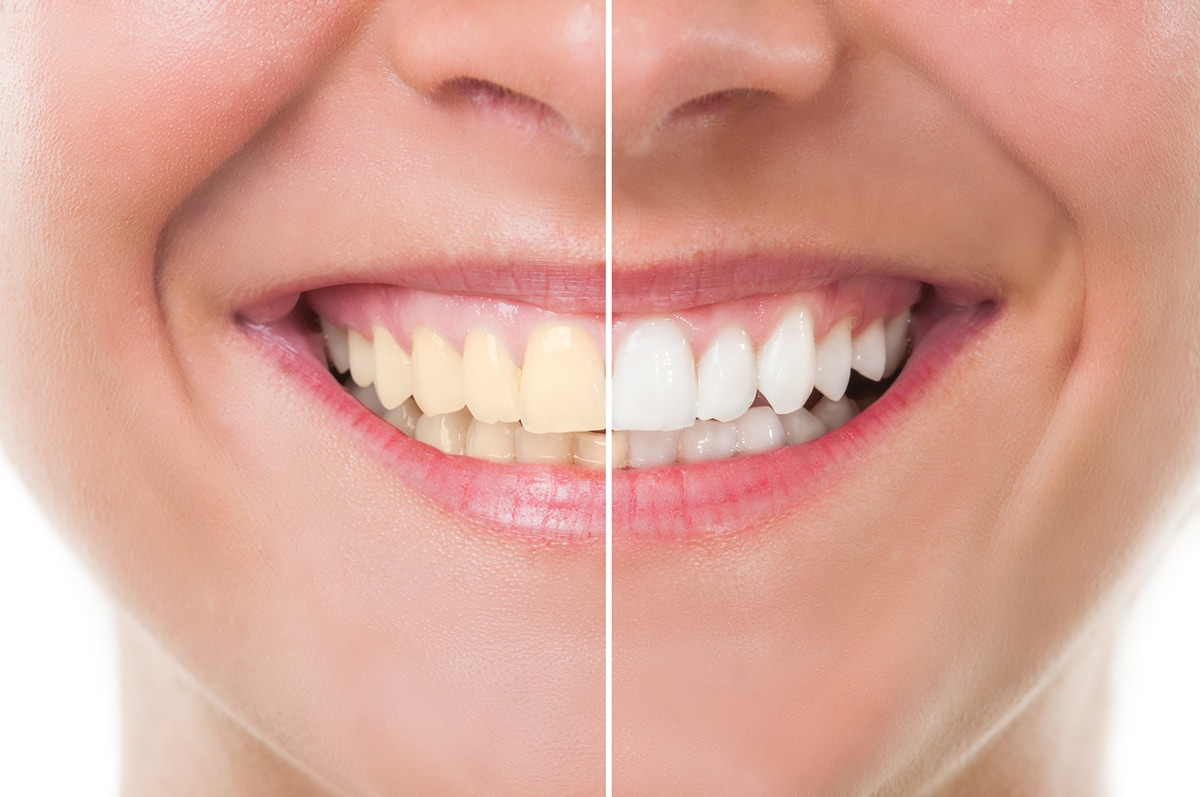Cosmetic-Dentistry